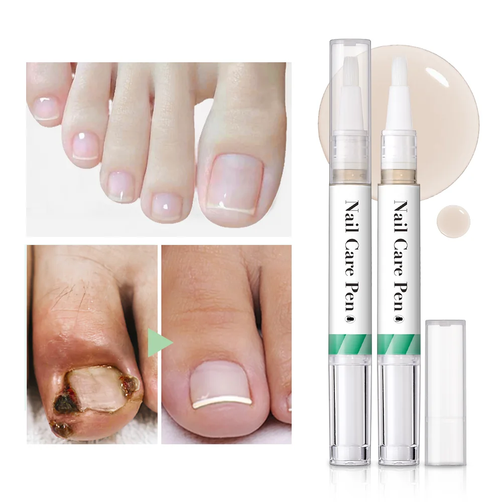 Pluma de aceite para cutículas, cuidado de uñas, manicura Natural, pluma de nutrición portátil para restaurar uñas fuertes y saludables