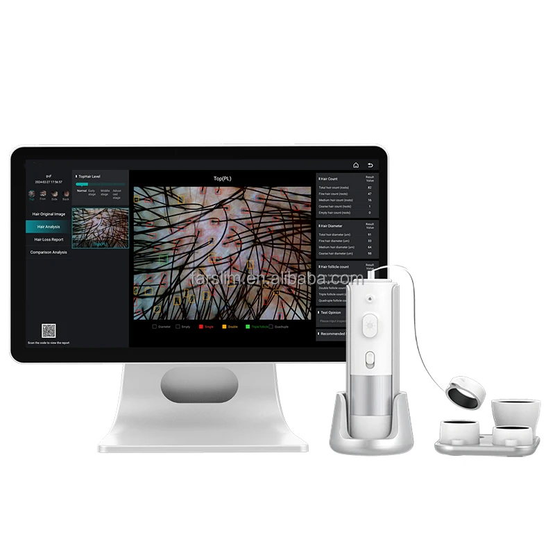 

2024 Top Selling HD Hair Follicles Scalp Scanner Detector Hair Analyzer Skin and Scalp Hair Analysis Microscope Beauty Machine