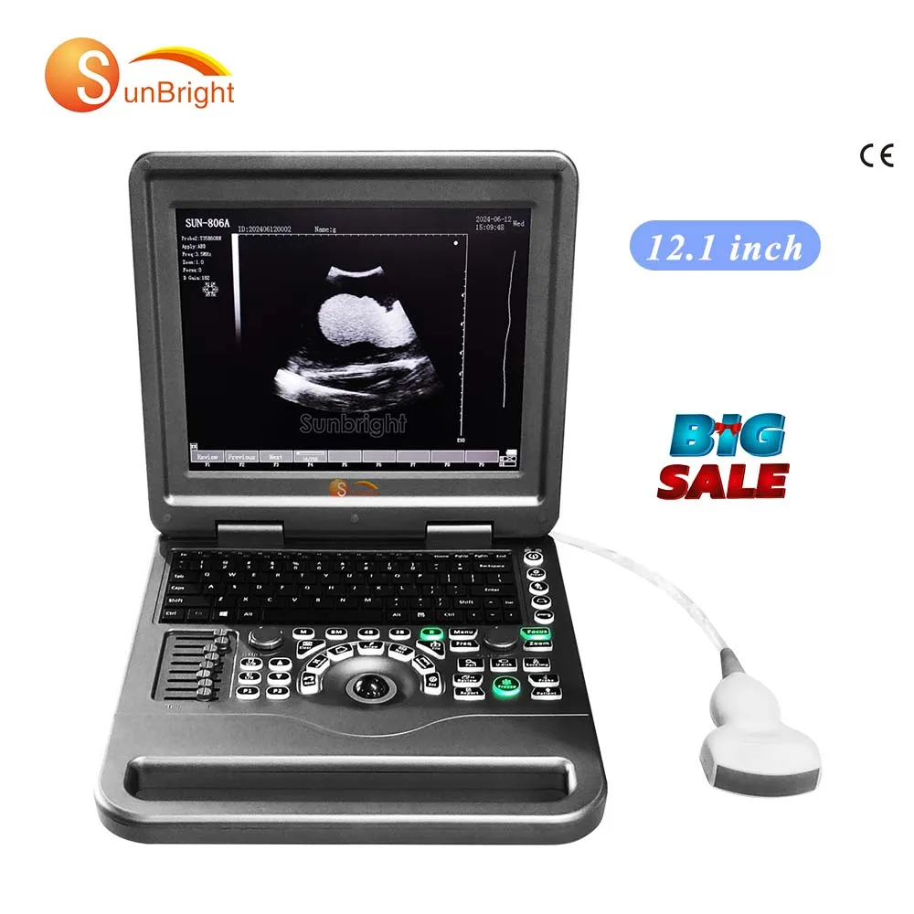 System preset ultrasound user friendly large battery ultrasound