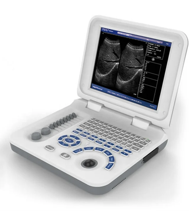 

XF30B 10 inches medical ultrasound instruments veterinary ultrasound portable Black and white ultrasound scanner