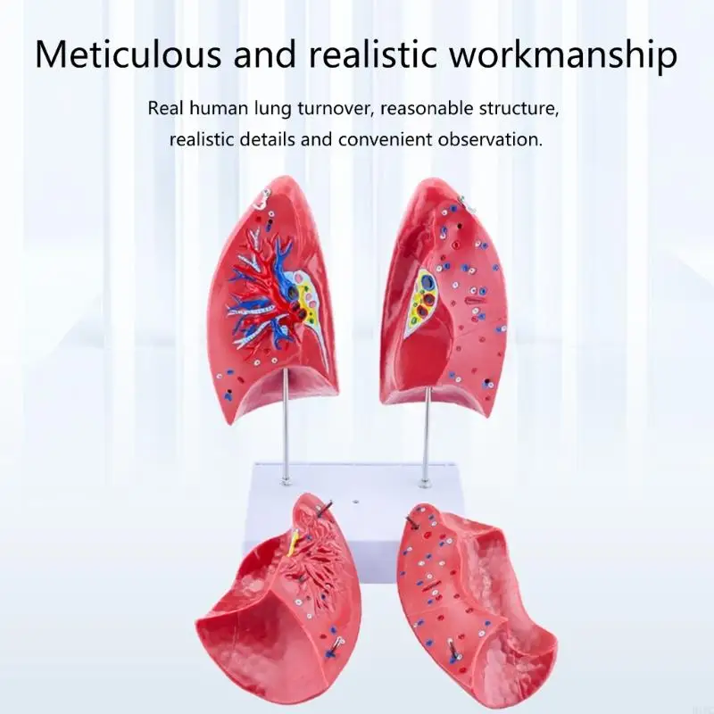 Anatomical Normal Lung Model with Removable Components for Clinical Teaching