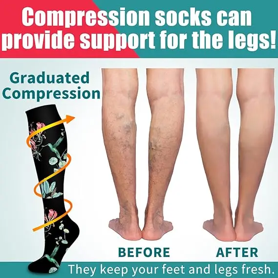 Running Compression Socks Knee High Women Pregnant Edema Diabetes Varicose Veins Marathon Sports Socks Nurse Socks 1 Pair