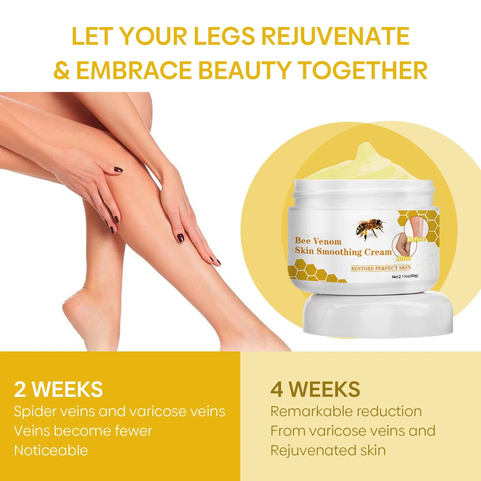 Ximonth Bee Venom Vein Repair Cream Varicose Vein Treatment to Repair Bent Veins clear the blood vessels Skin Smoothing Cream