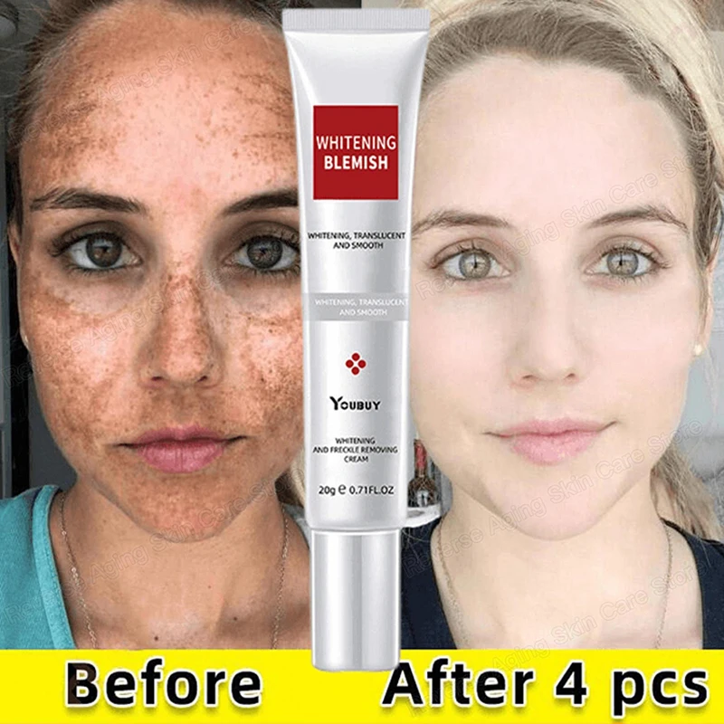 

Whitening Freckle Removing Cream Effective Brighten For Face Spots Remove Dark Spot Melasma Anti-pigmentation Improve Dullness