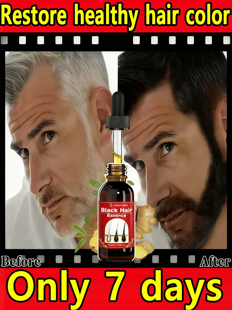 

Вау! Эта сыворотка для краски для волос может восстановить натуральный черный цвет вашего волос в том же неделю! Скажи прощайте с седыми волосами!