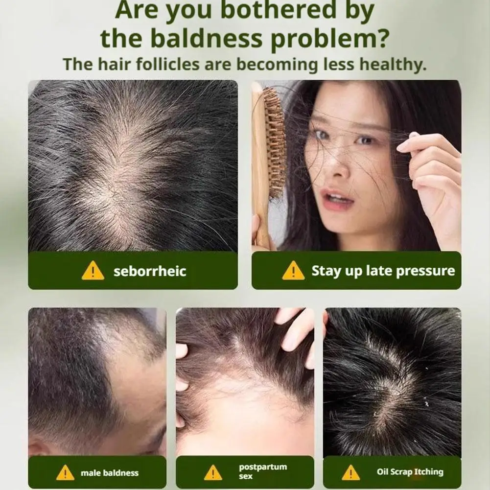 Champú de hierba Usman de hoja de ciprés, jabón para picazón, Control de aceite limpio, cuidado del cabello, planta pura, jabón calmante para el folículo del cabello, 3 uds.