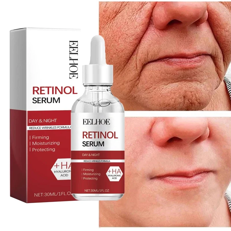 Sérum anti-âge raffermissant et liftant au rétinol pour le visage, élimine les déformations, estompe les ridules, anciers pour les yeux, améliore les poches, soins de la peau, collagène