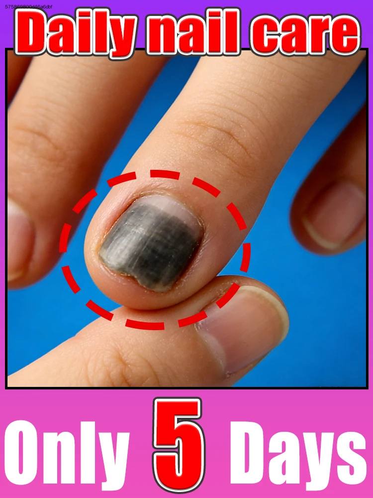 

Bʀᴇᴀᴋ ᴀᴡᴀʏ ғʀᴏᴍ ᴅʀʏ ᴄʜᴀᴘᴘᴇᴅ ᴄᴜᴛɪᴄʟᴇs, ɴᴀɪʟs sᴛᴀʏ sᴛʀᴏɴɢ ɴᴏᴜʀɪsʜᴇᴅ