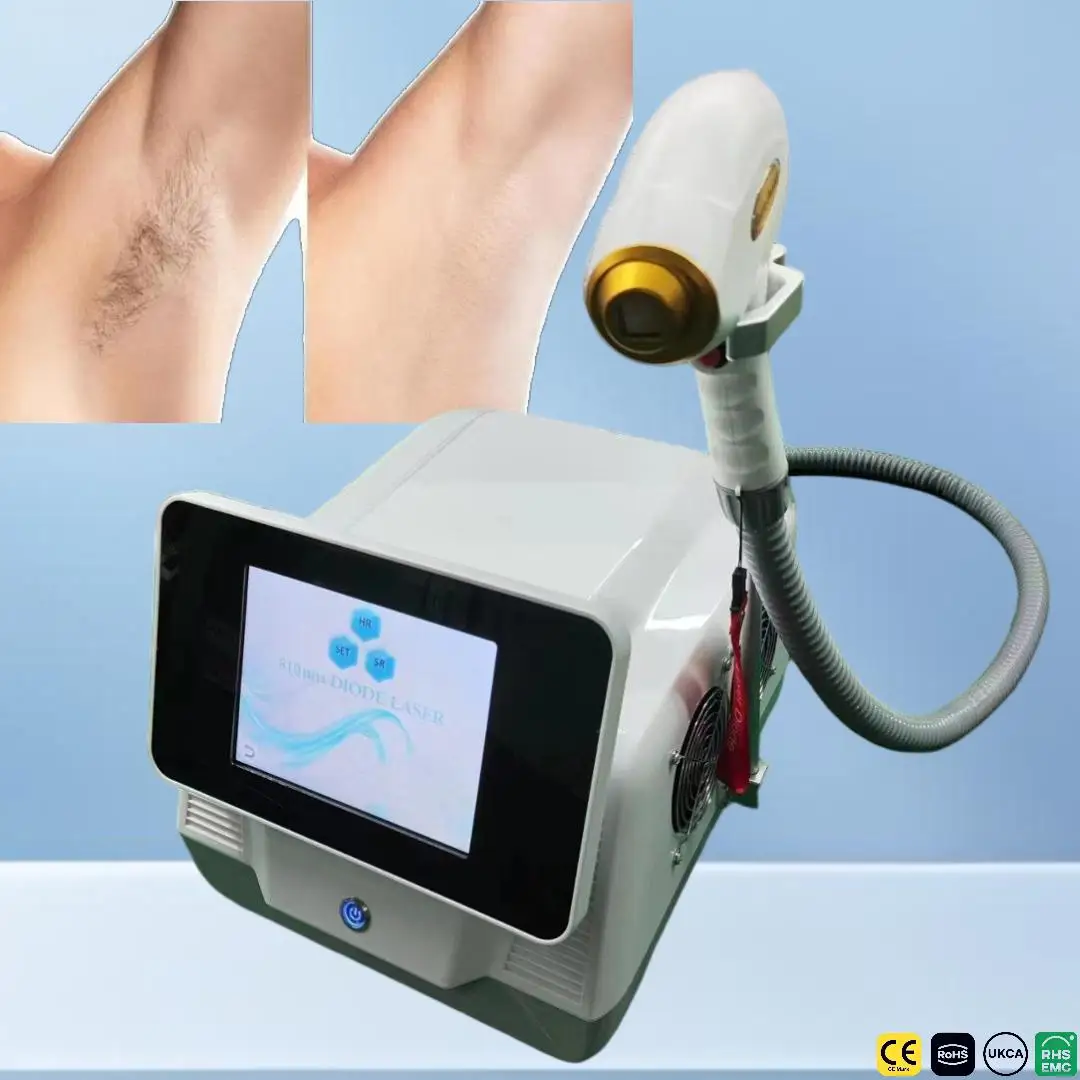 Professional Mini 4Wavelength High Power Alexandrite 755nm 808nm 940nm 1064nm Hair Removal Machine Factory Customized CE 2026