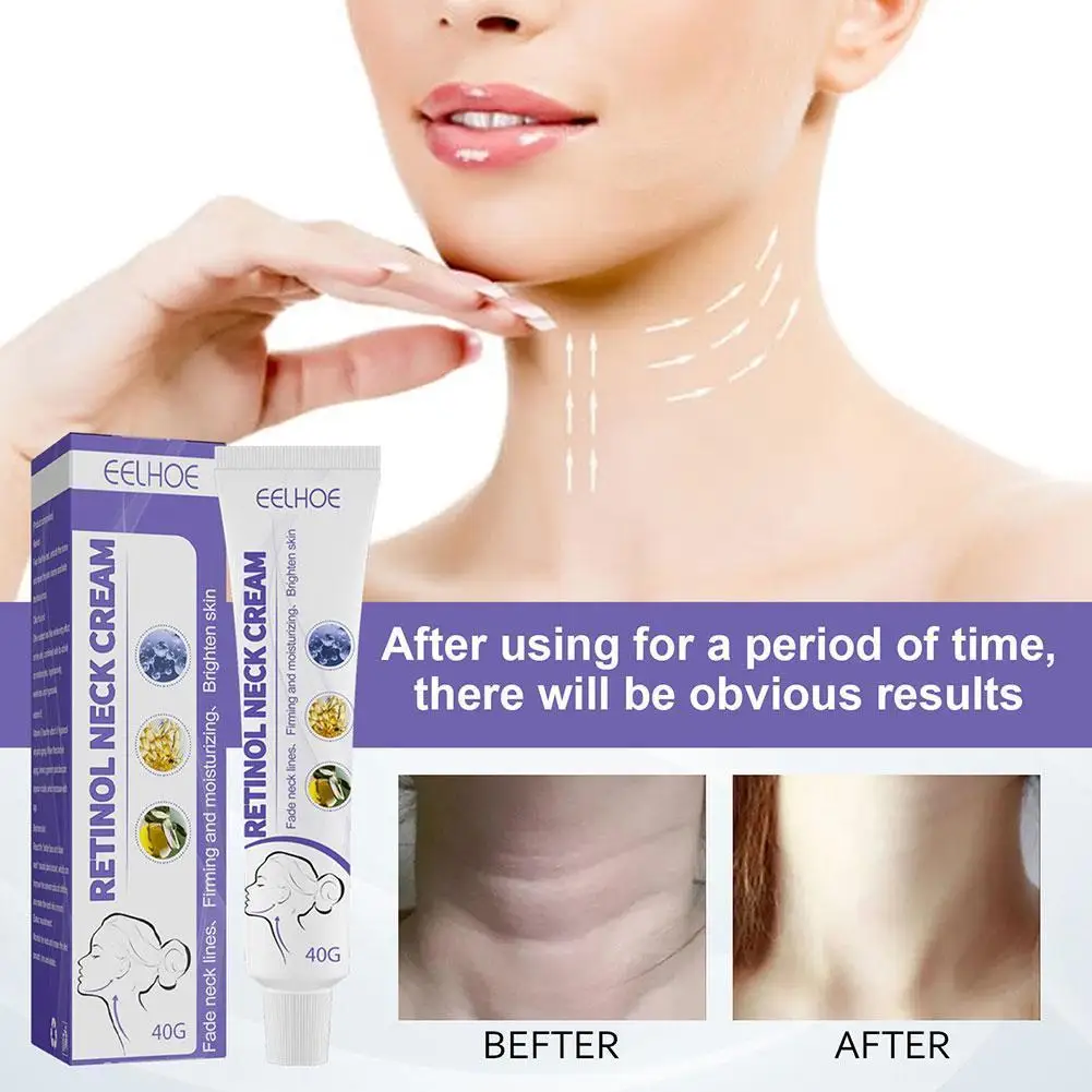 Retinol-Creme Removedor de Rugas, Anti-Envelhecimento, Facial, Pescoço, Clareamento da Pele, Hidratante, Nutritivo, Cuidado com Formas, 40g