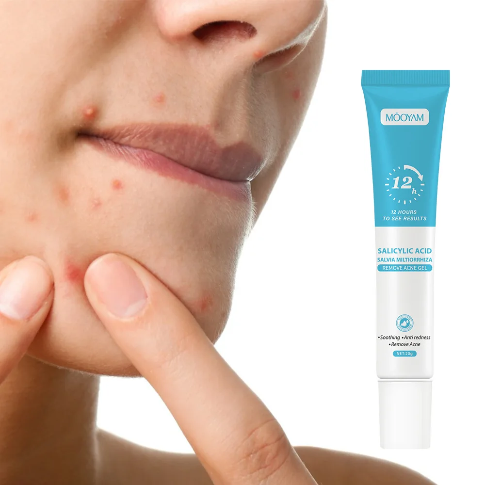 creme-facial-com-Acido-salicilico-para-melhorar-acne-gel-reparador-de-espinhas-controle-de-oleosidade-reduz-poros-hidratacao-e-cuidado-da-pele