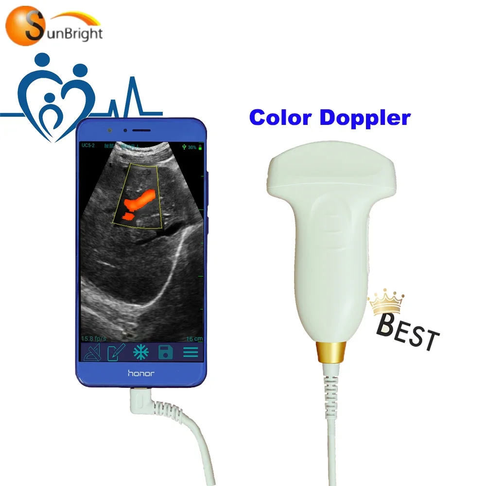 Cheapest USB 2D Portable wireless usg probe android ultrasound for android