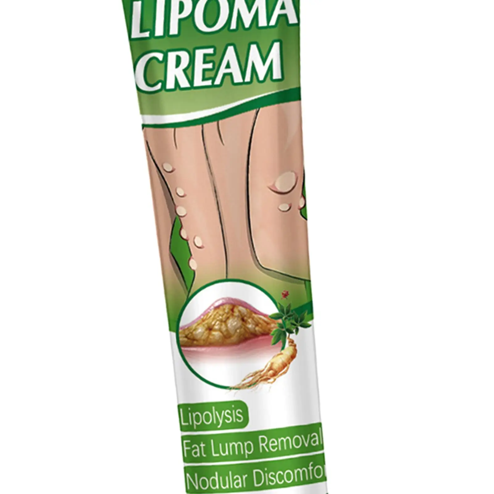 Crema per la rimozione del lipoma da 0,71 fl.oz Crema portatile per la cura della pelle Disagio nodulare Rimozione del lipoma