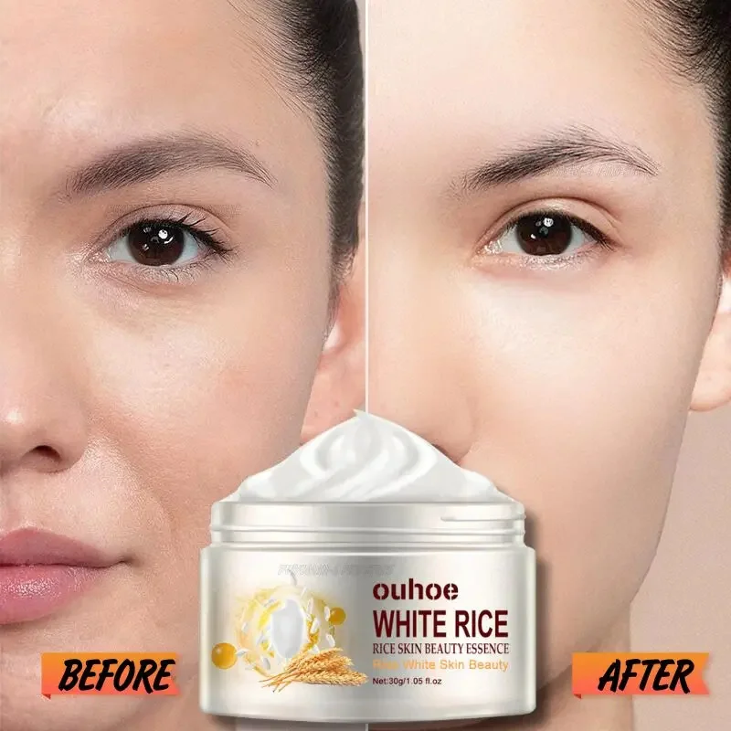 Rice Anti-wrinkle Facial Cream Acne Melasma Treatment Pigmentation Whitening Face Lifting Beauty Moisturizer Korean Cosmetics30g