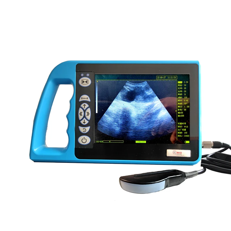 

Portable veterinary cattle ultrasound 3.5MHZ convex array probe scanning ultrasound diagnostic instrument high configuration