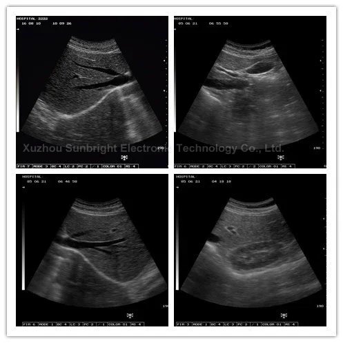 Laptop B/W Full Digital 12.1 inch vet Ecograph Scanner 2D Ultrasound