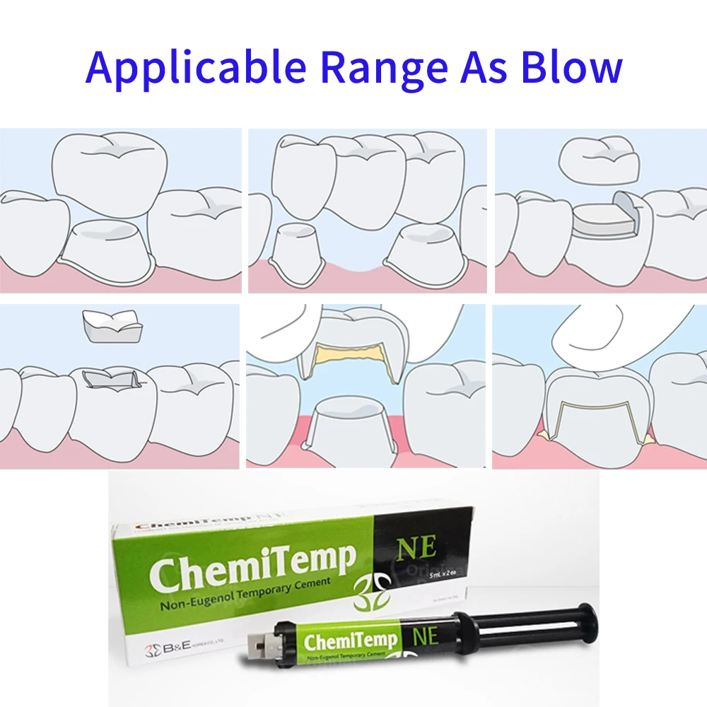 Temporary Glue Cement For Crowns & Bridges Teeth Implant Temp Self Adhesive Automix Stick Bond Dental Dentist Materials Products