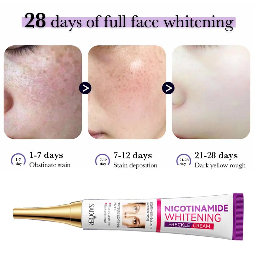 Niacinamida Whitening Freckle Cream, Eficaz Ilumina, Manchas pretas, Acne Marcas, Remove Melasma, Ilumina Saudável, 1-5 Pcs