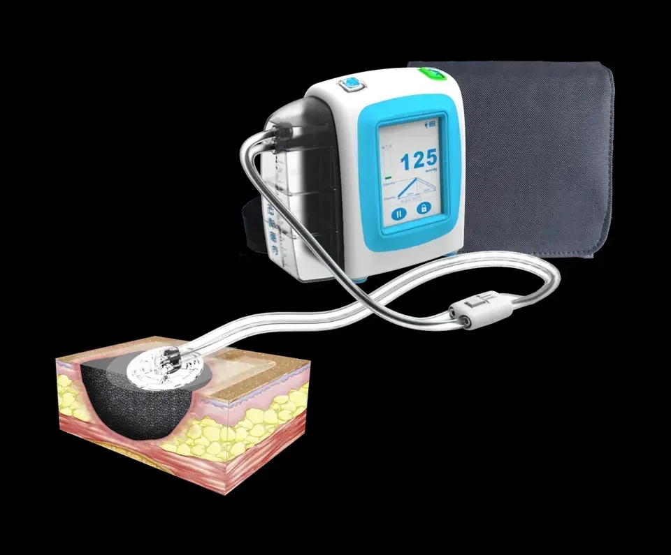 Negative pressure wound therapy machine medical device using in hospital with NPWT system kit canister450ml