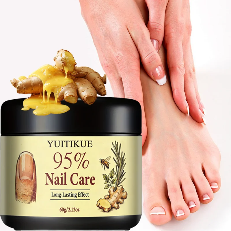 YUITIKUE 95% Nail Care Cream | Long-Lasting Nourishment | Natural Ginger & Rosemary Formula For Healthy Strong Nails 60g