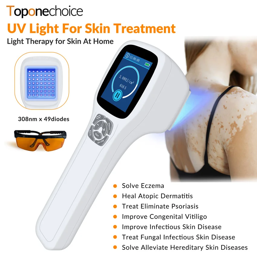 

308nm Excimer Light Vitiligo Phototherapy Instrument UVB Ultraviolet Lamp Laser Therapy Instrument for Psoriasis White Spot