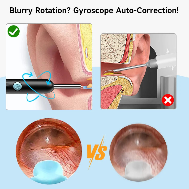 4.2mm WiFi Endoscope HD 1080P Ear Picker Camera for iOS/Android Phones Waterproof Wireless Otoscope Dig Ear Wax Skin Check