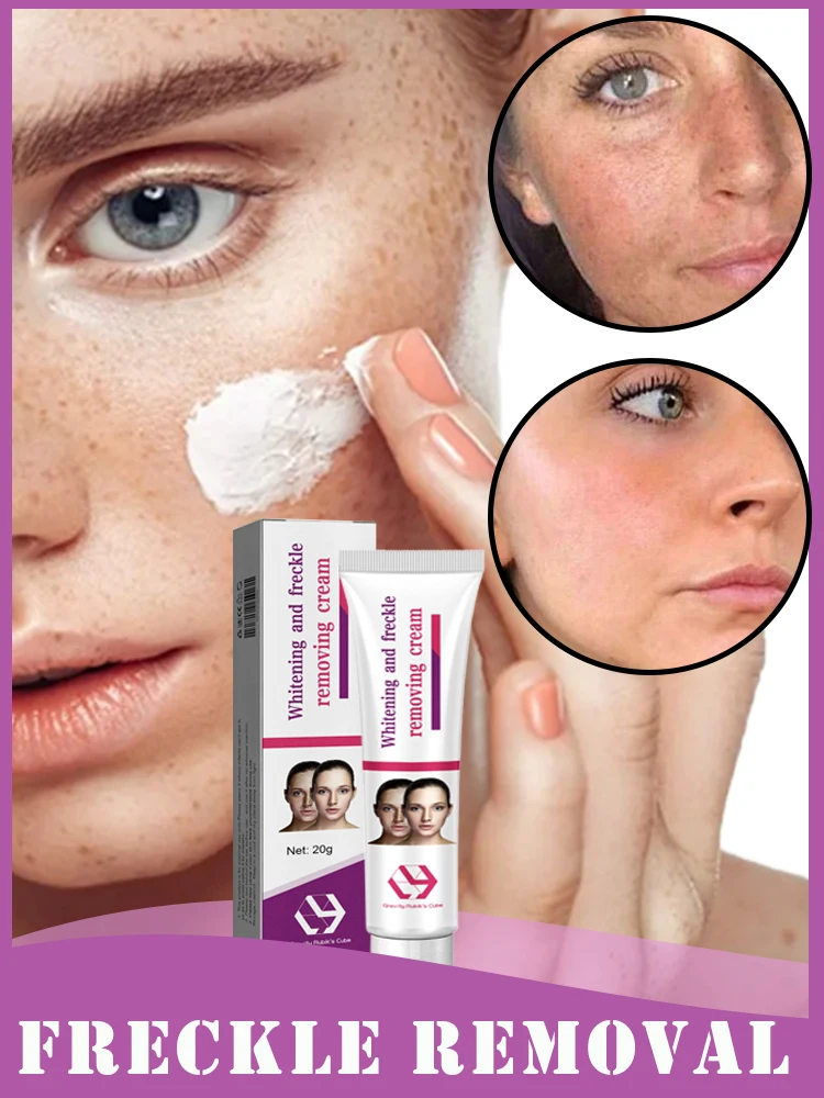 

Freckles Cream Dark Spot