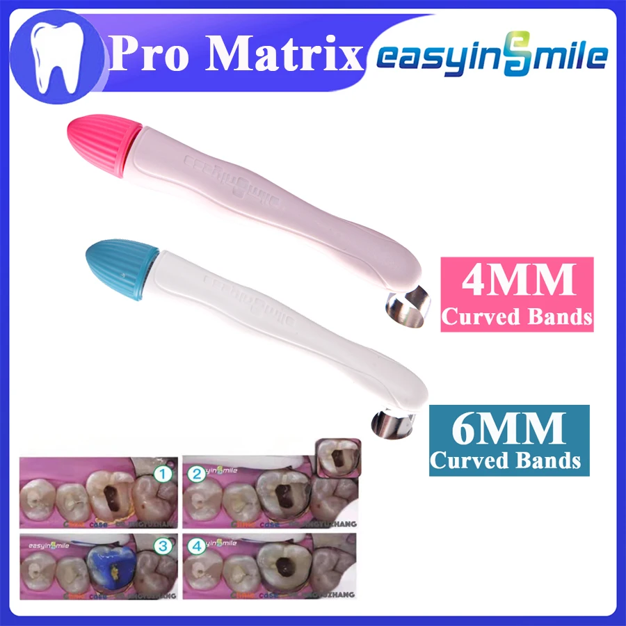 

50/Pk Dental pro matrix bands stainless steel Matrices Curved bands 4.5MM/6MM Adjust hold