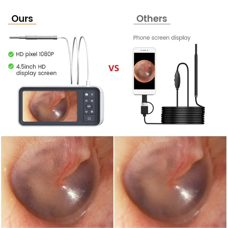 4.5 inch 1080P HD Screen Otoscope 3.9mm Ear Wax Camera Ear Scope Endoscope with 2500mAh Rechargeable Battery and 32GB SD Card