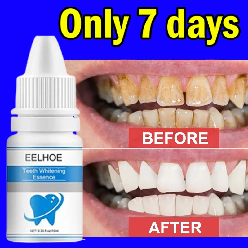 Removing Tartar Stains Teeth Cleaning Brighten