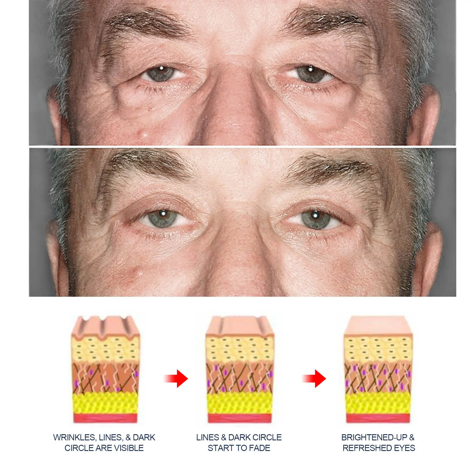 Crème pour les yeux au rétinol pour hommes, élimine les poches sous les yeux et les cernes, raffermissante, décolorante, ridules, hydratante, éclaircissante, réparatrice