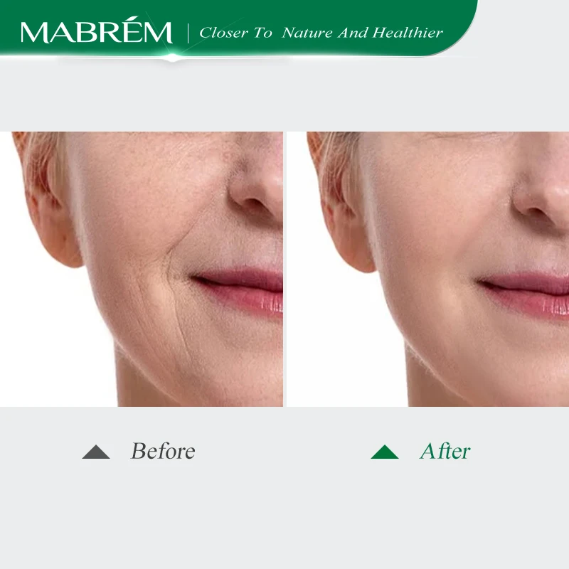 MABREM Moisturizing Cream Anti-Aging Whitening Wrinkle Removal Repair pores Relieves Rough And dry Calendula Firming Care 35g