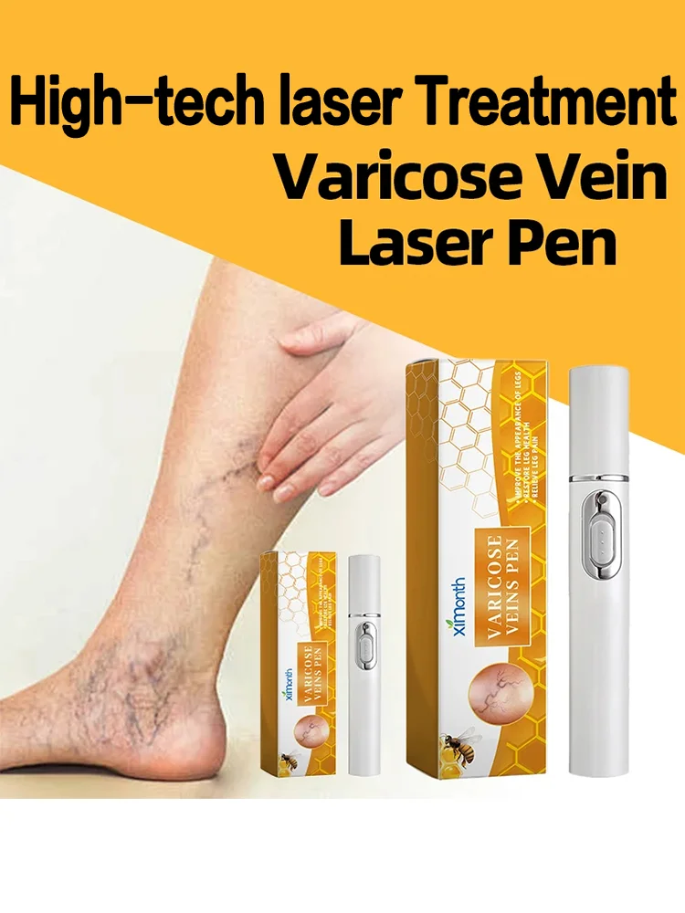 

Varicose Veins Laser Therapy Pen Improves Moderate Varicose Vein Relieve Leg Pain Improve Blood Circulation For Men And Women