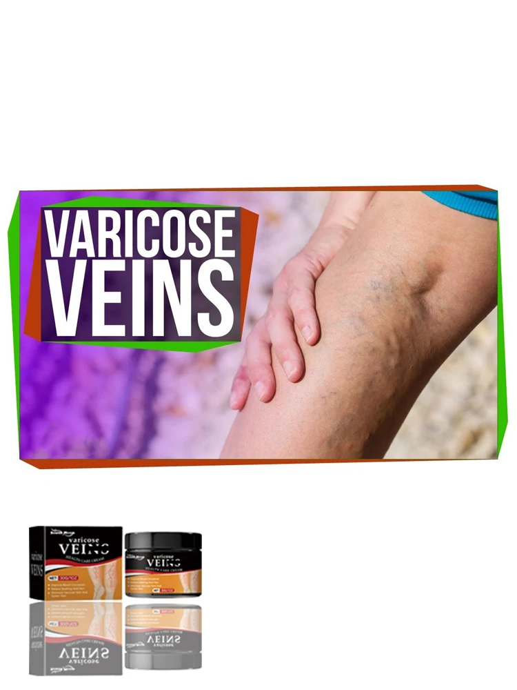 30g Crema para venas varicosas Desvanece las venas de araña Mejora la circulación sanguínea Uso de la mañana y la noche