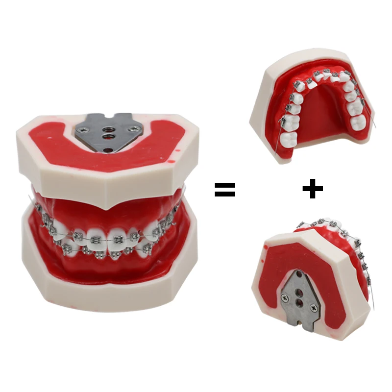 Dental Teeth Model with Braces Orthodontic Model Teaching Studying Education Demonstration Model Dental Materials