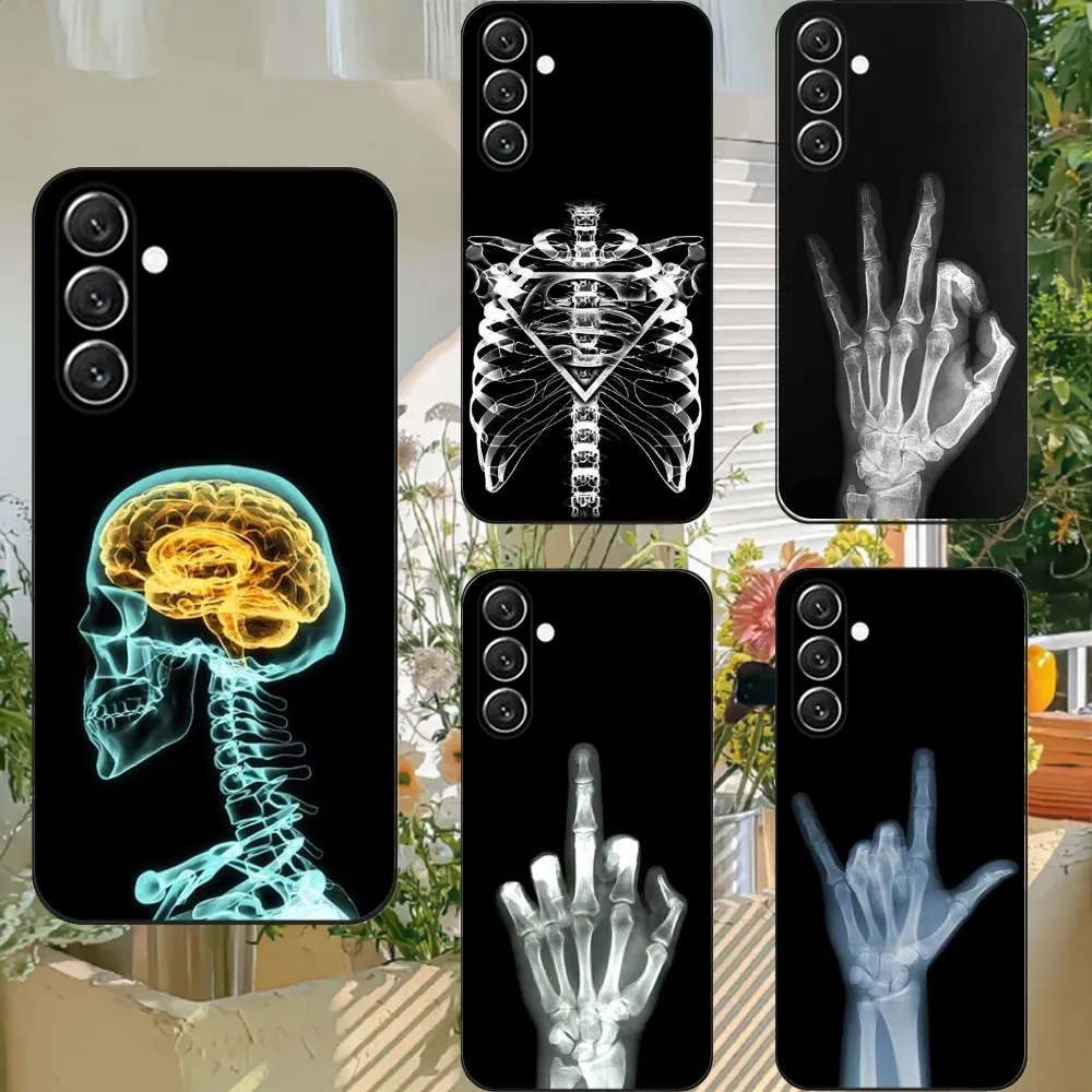 

Radiological human organs Skeleton Phone Case For Samsung S21,S22 Ultra,S20,S30 plus,S22 plus,S23,S30 ultra 5G Silicone Cover