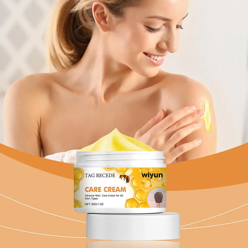 Bienen warze Pflege creme Entfernung Warze feuchtigkeit spendende und glättende Hautpflege creme Reparatur Hautrötung und Juckreiz Körperpflege 30g