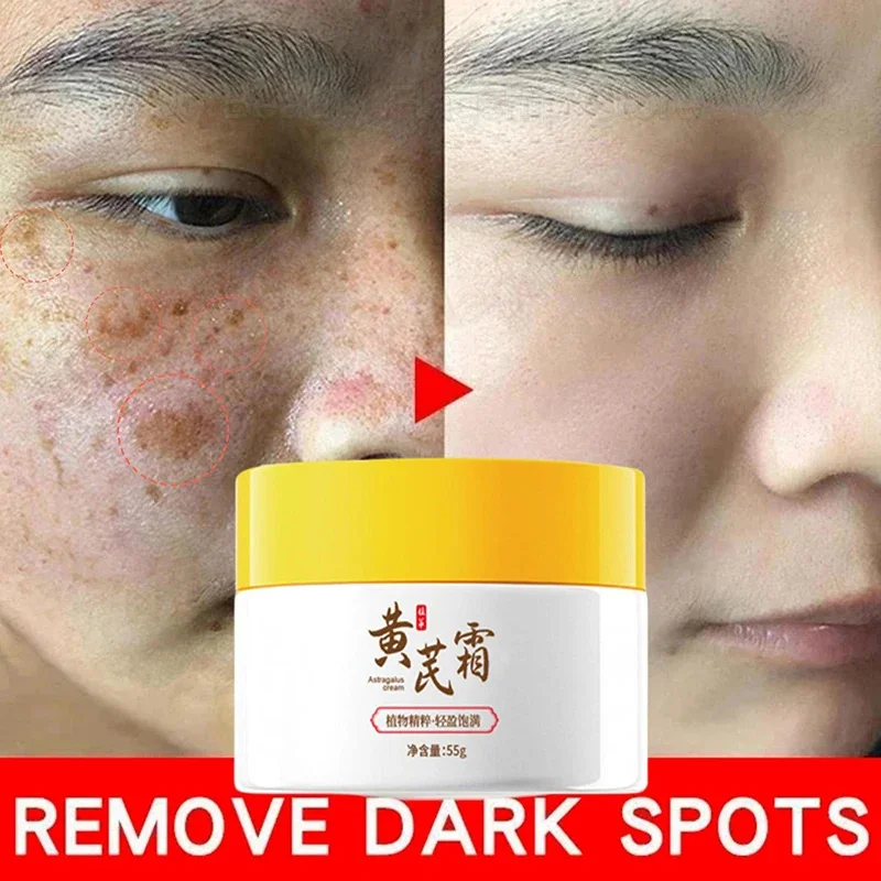 

Astragalus Whitening Freckles Cream Face Dark Spots Remover Repair Products Removal Melasma Melanin Moisturiz Brighten Skin Care