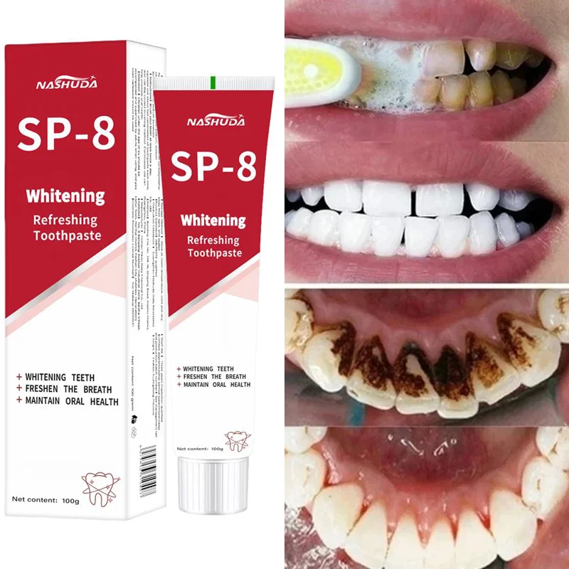 

SP-8 Probiotic Toothpaste Whiten Clean Teeth Remove Stains Oral Care Management Fresh Breath With Sodium Saccharin Lactobacillus