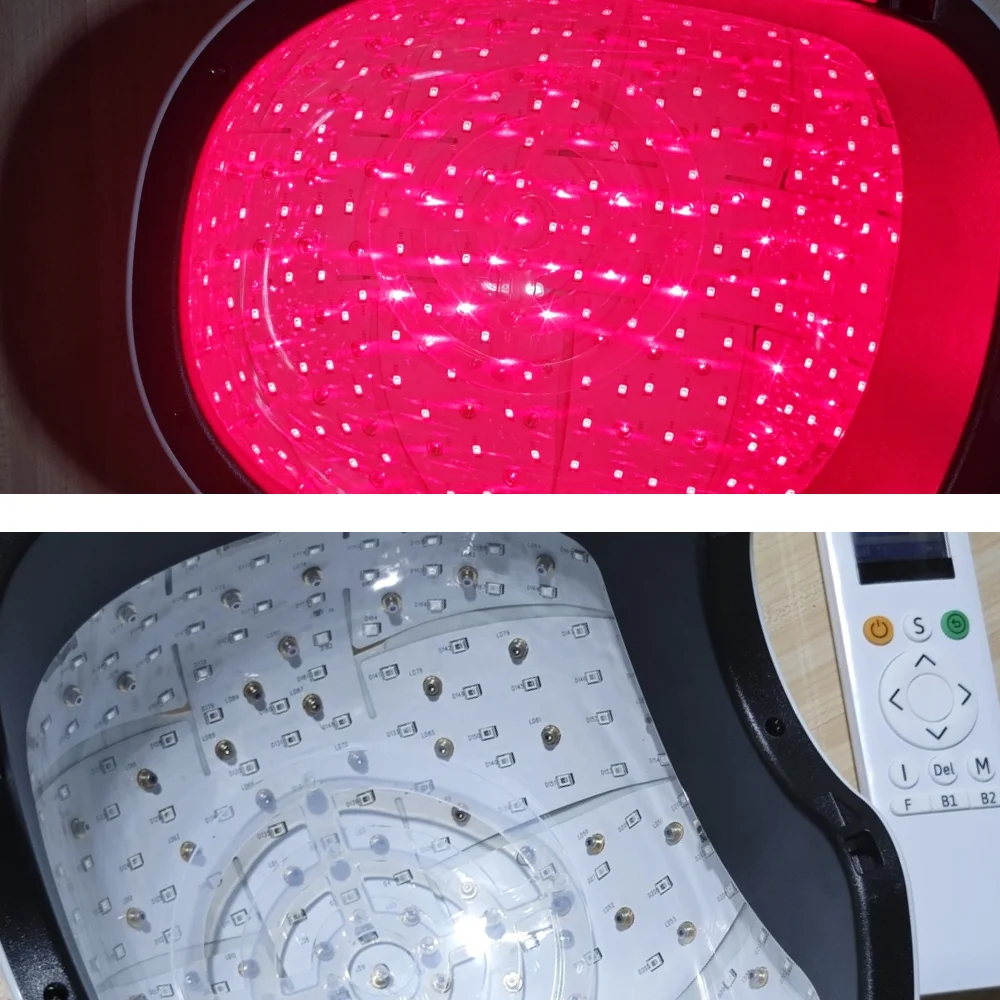 

Лазерная шапочка для восстановления волос, 266 диодов, LLLT, лазерная терапия для улучшения роста волос, шапочки для покрытия кожи головы для мужчин, рост волос 510K