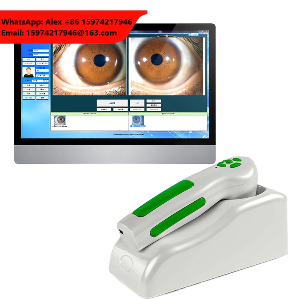 Wufeng WF-9822U Multi-Functional Iridology Camera Body Health Detector CE Certified USB Rechargeable Electricity Class II