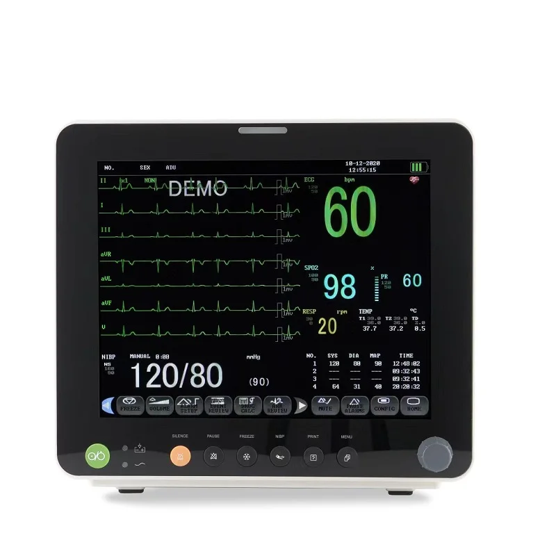 Guangzhou UMY Medical Hospital Portable Multi Parameter 15 Inch ECG Vital Signs Patient Monitor
