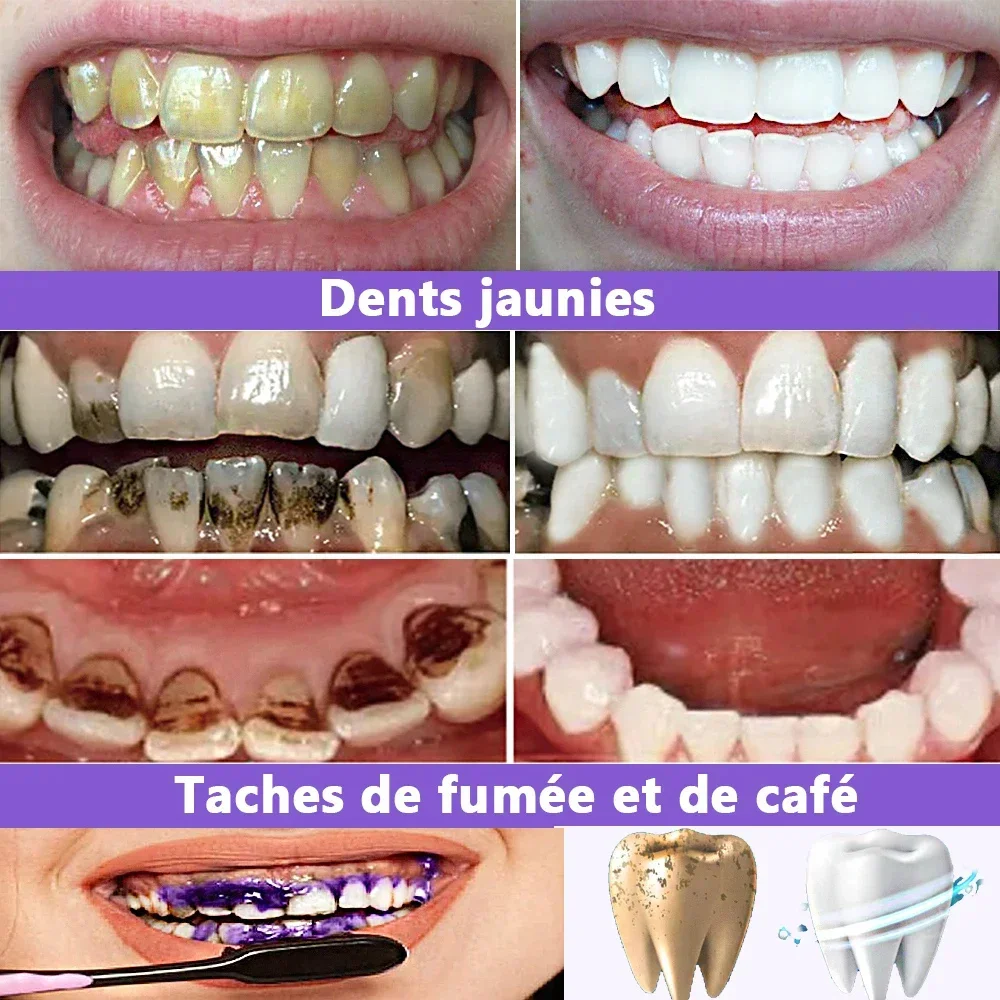 Pluma de pasta de dientes V34 para blanquear, Limpieza de manchas de placa, higiene bucal, herramientas dentales, aliento fresco, cuidado Dental