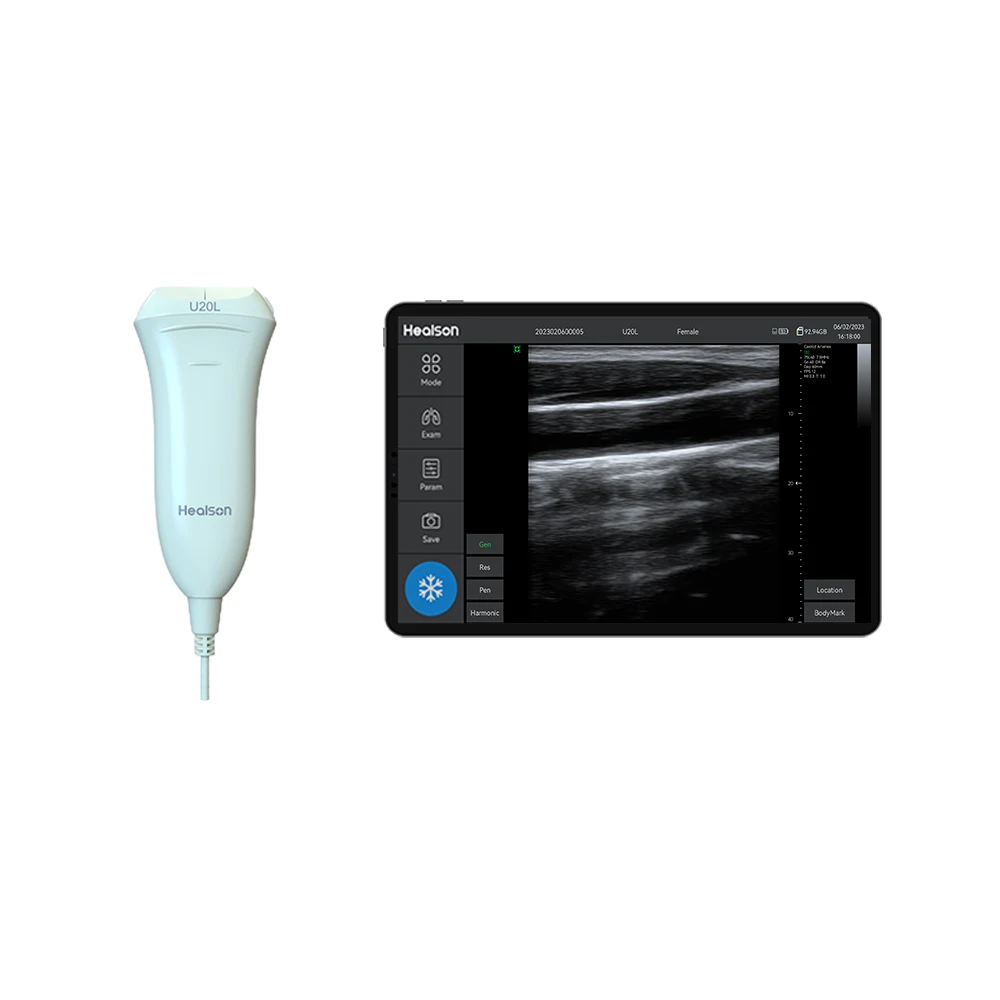 Good quality single head B Ultrasound scanner Linear USG probe for human Vascular, MSK, Superficial, Thyroid, Small Parts, etc.