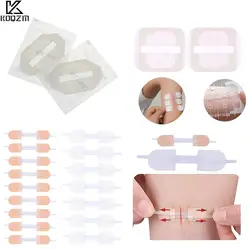 Band-Aid Zipper Tie Wound Closure Patch Hemostatic Patch Wound Fast Suture Zipper Band-Aid Outdoor Portable