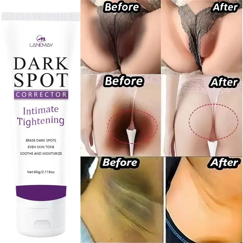 Whitening Cream Private Parts Underarm Bleaching Serum Whiten Butt Knee Brighten Inner Thigh Intimate Parts Dark Remove Melanin