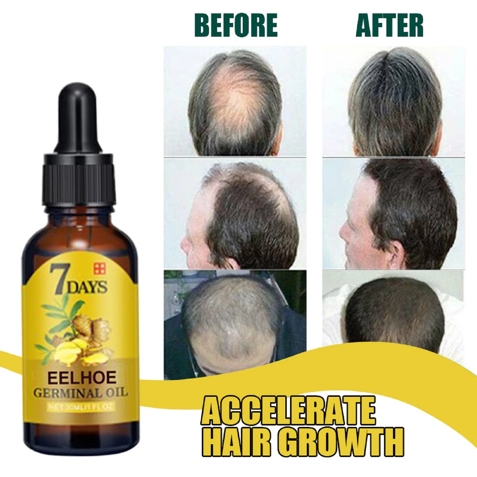 EELHOE Ginger Hair Growth Oil Natural Essentail Anti-Hair Loss Treatment Hair Hydrating Growth Nutrient Solution Care Products