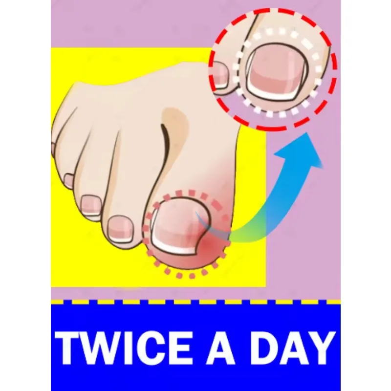 

Генерация-2, омоложение - технология предотвращения грибка - регулируемый датчик управления и безопасности