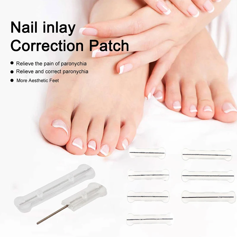 Ingrown Toenail Correction Tool Ingrown Toe Nail Treatment Elastic Patch Sticker Straightening Clip Brace Pedicure Tool