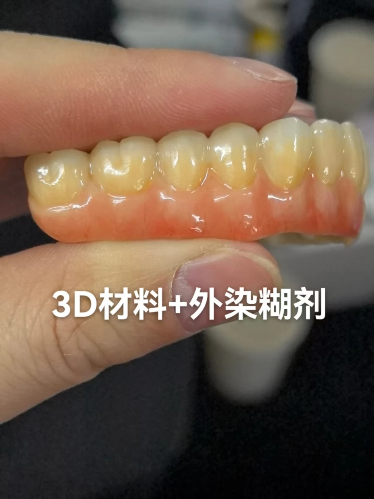 เวิลด์ลิงค์ 5g ชุดเจือจางครีมทาและเคลือบสำหรับมงกุฎและสะพานเซอร์โคเนียเต็ม 1 ขวด